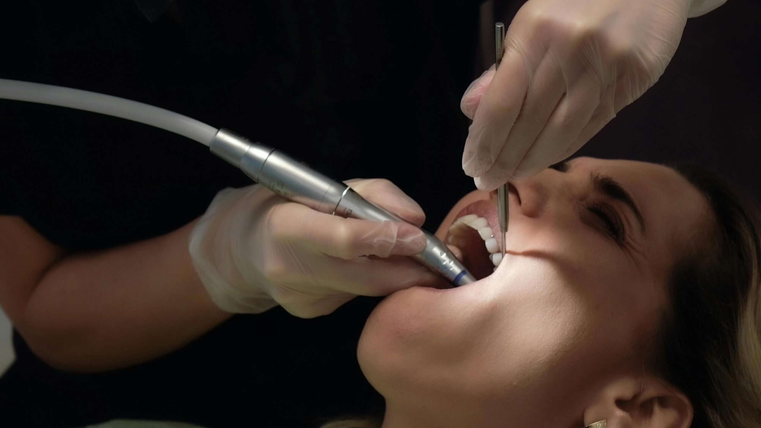 image of someone getting a wisdom tooth extraction - oral surgery