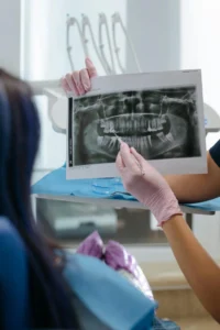 Dental patient looking at a image of a dental x-ray