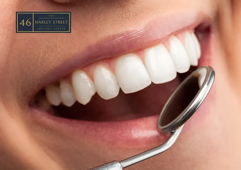 Smile with good teeth getting checked